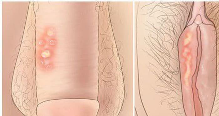 Jual Obat Sipilis De Nature Pengiriman ke Toli-Toli