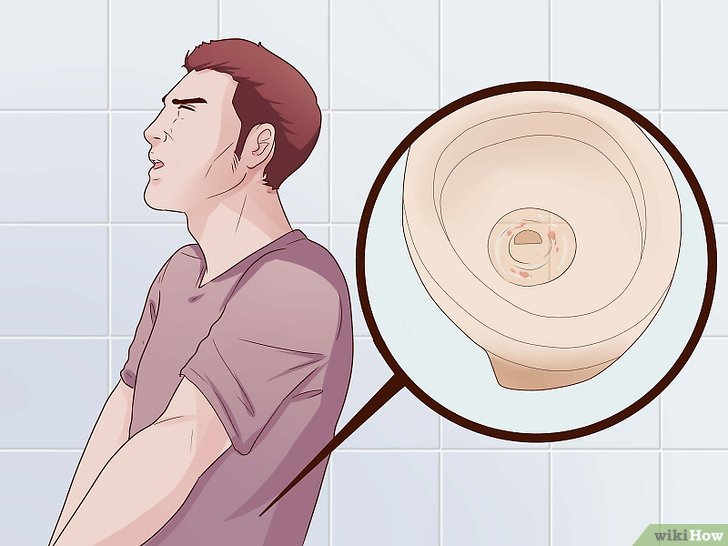 Jual Obat Sipilis De Nature Pengiriman ke Pulau Taliabu