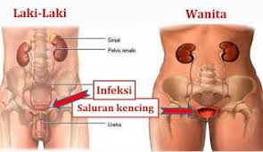 Jual Obat Sipilis De Nature Pengiriman ke Pontianak
