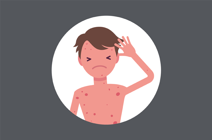 Jual Obat Sipilis De Nature Pengiriman ke Takalar